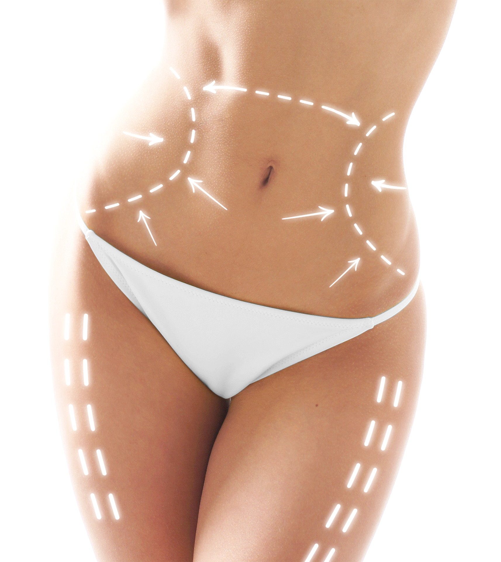Lipoaspiración VASER