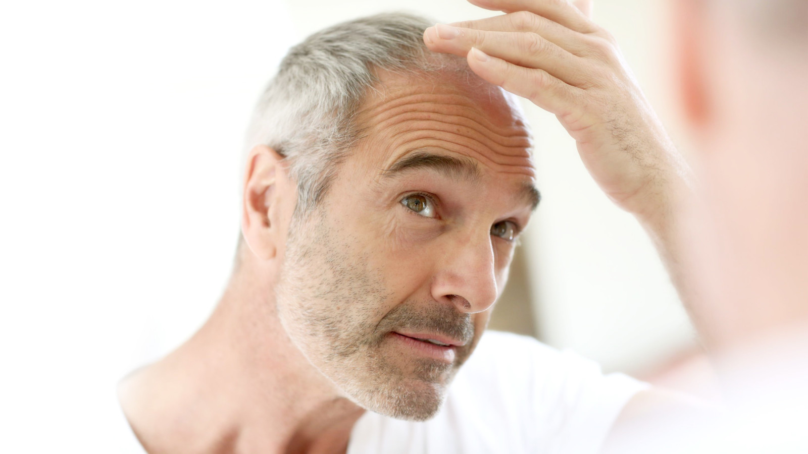 Microtransplantes de cabello